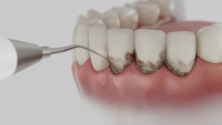 Reliable Dental Implants contractor in Johnson Lane, NV by Smile Center Dentistry